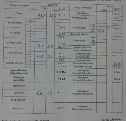 Жизнь 13-летней Камиллы в наших руках – нужна срочная помощь (ВИДЕО)
