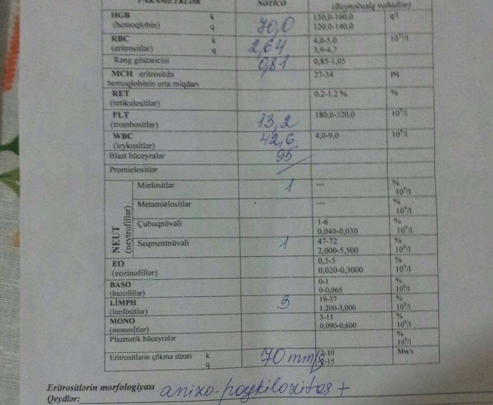 Жизнь 13-летней Камиллы в наших руках – нужна срочная помощь (ВИДЕО)