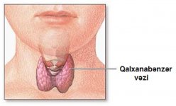 Почему возникает зоб – симптомы, лечение (ФОТО)