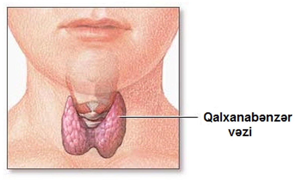 Почему возникает зоб – симптомы, лечение (ФОТО)