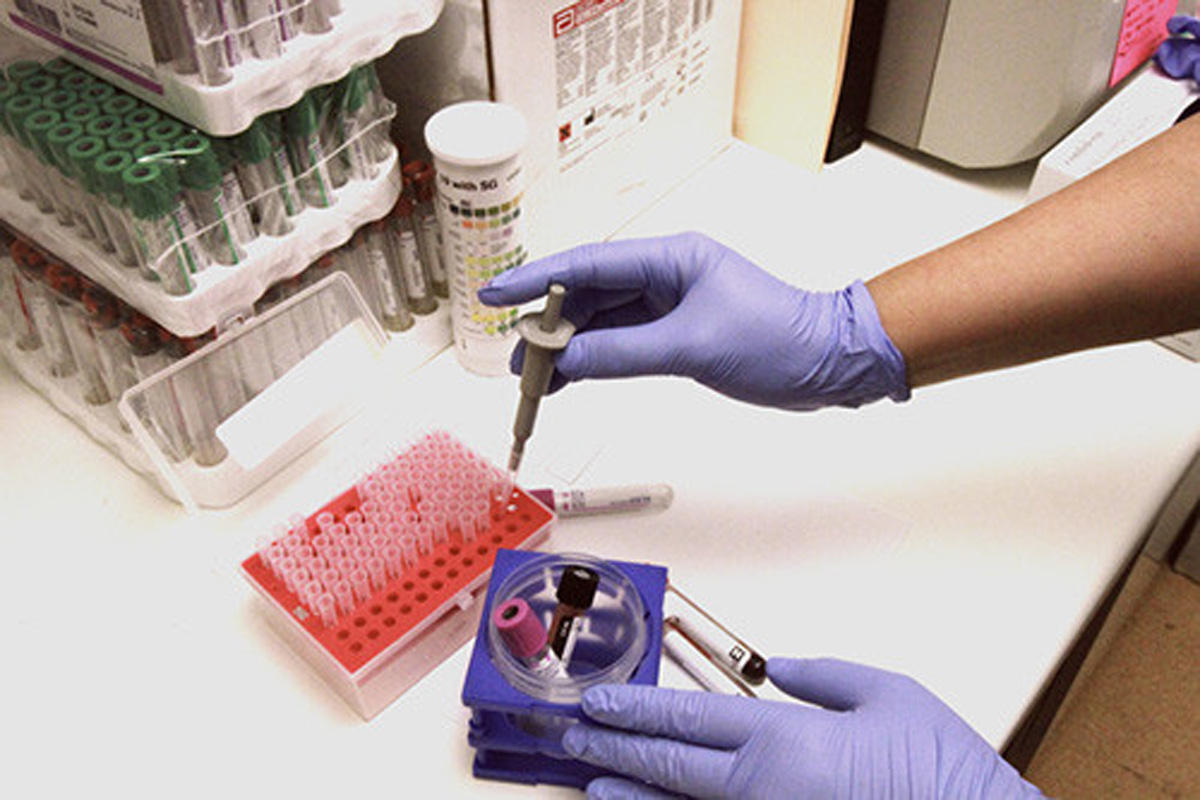 Что такое токсоплазмоз и как от него уберечься?(ФОТО)