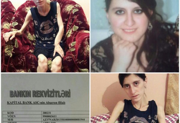 У Айшан врожденный синдром Маделунга – призыв о помощи (ФОТО)