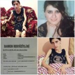 У Айшан врожденный синдром Маделунга – призыв о помощи (ФОТО)