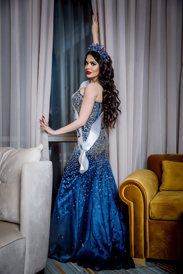 Самая красивая девушка Баку в новогодней фотосессии (ФОТО)