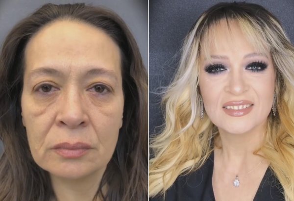 Заслуженная артистка Азербайджана Мехрибан Ханларова изменилась до неузнаваемости (ФОТО, ВИДЕО)