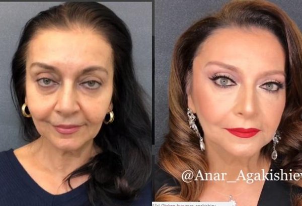 Народная артистка Азербайджана Гамида Омарова изменилась до неузнаваемости (ВИДЕО, ФОТО)