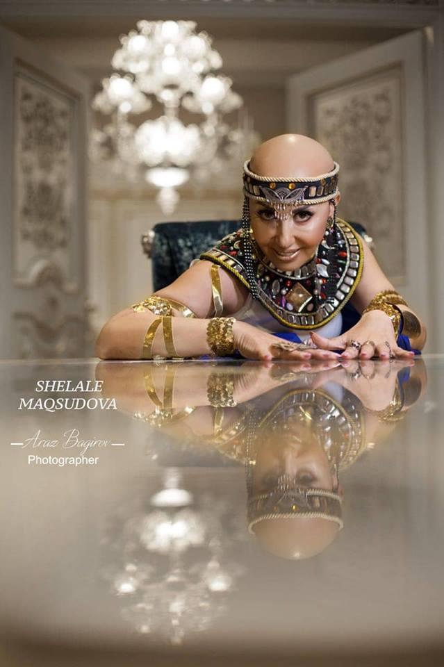 Вот это смелость! Больная раком Зульфия Байрамова предстала в гламурном образе (ФОТО)