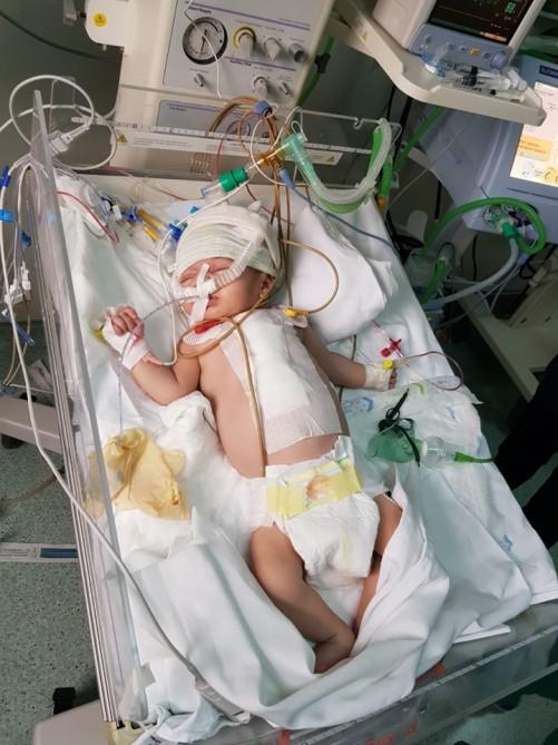 Азербайджанские врачи спасли жизнь двухмесячного ребенка (ФОТО)
