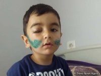 Мальчику, покусанному собакой в Баку, сняли швы, вакцинация продолжается - врач (ФОТО)
