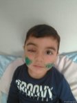 Мальчику, покусанному собакой в Баку, сняли швы, вакцинация продолжается - врач (ФОТО)
