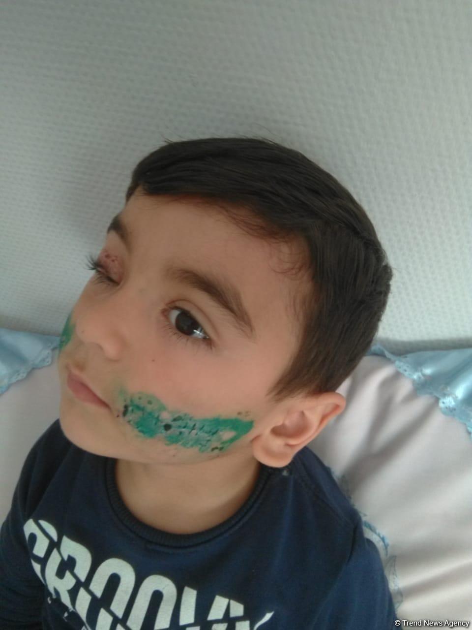 Мальчику, покусанному собакой в Баку, сняли швы, вакцинация продолжается - врач (ФОТО)