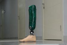 Еще трое раненых участников Отечественной войны Азербайджана обеспечены высокотехнологичными протезами (ФОТО)