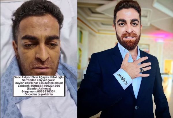 34-летний азербайджанский актер находится в тяжелом состоянии. Трое детей могут остаться сиротами