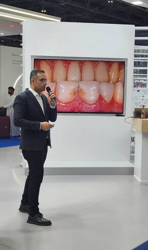 Более пятидесяти азербайджанских стоматологов принимают участие в AEEDC Dubai 2024 (ФОТО)