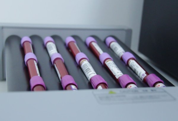 Предлагается создать Независимый механизм сравнения ДНК для идентификации личностей, пропавших без вести между Азербайджаном и Арменией