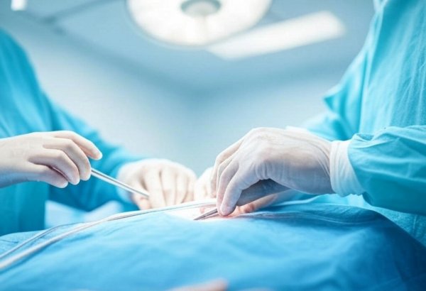 Более 90% дорогостоящих операций были проведены в частных медучреждениях - Счетная палата Азербайджана