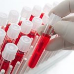 Минздрав Азербайджана напомнил о важности питания для профилактики анемии (ФОТО)