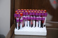 Азербайджанские актеры провели акцию во имя спасения жизней (ВИДЕО, ФОТО)